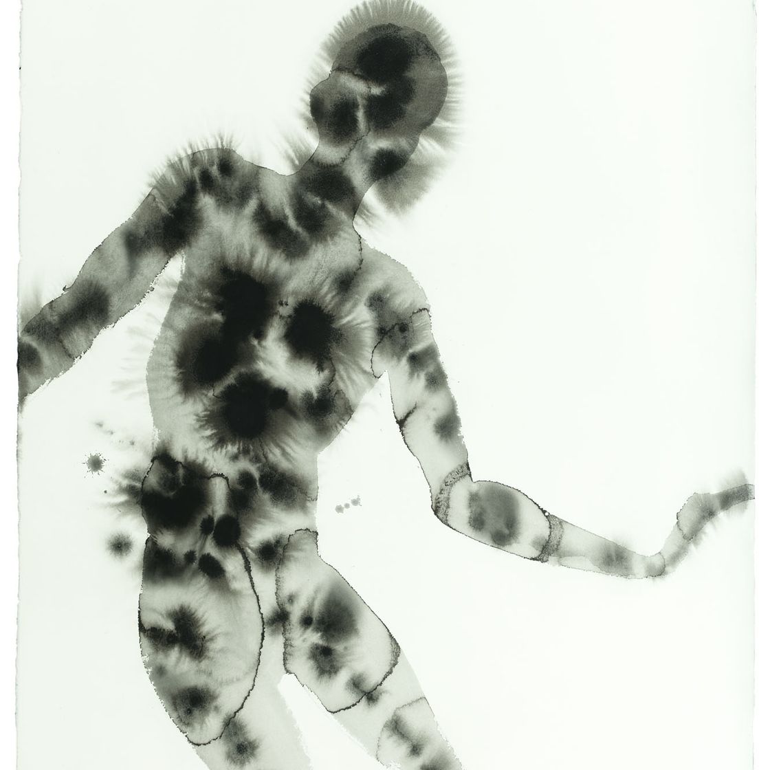 Antony Gormley — Патология III