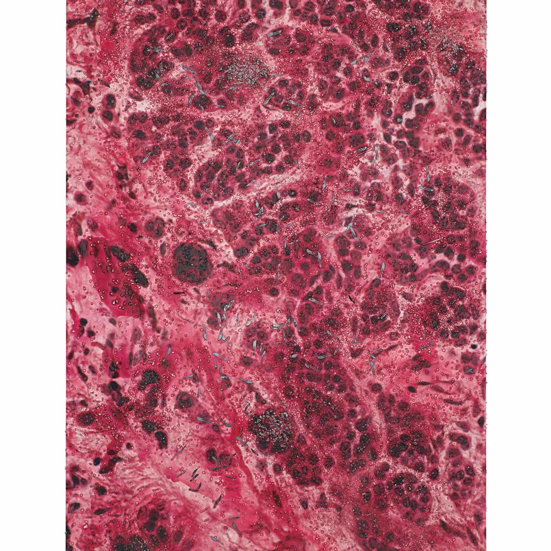 Damien Hirst — Родинка на коже M220/140, LM_SPL.jpg
