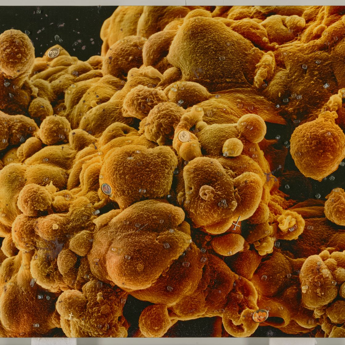 Damien Hirst — Биопсия второй серии: M865/302, M865/303, изображение 2