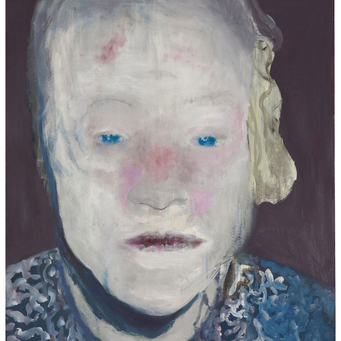 Marlene Dumas — Белая болезнь