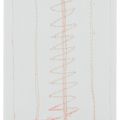 Louise Bourgeois — Без названия, изображение 1
