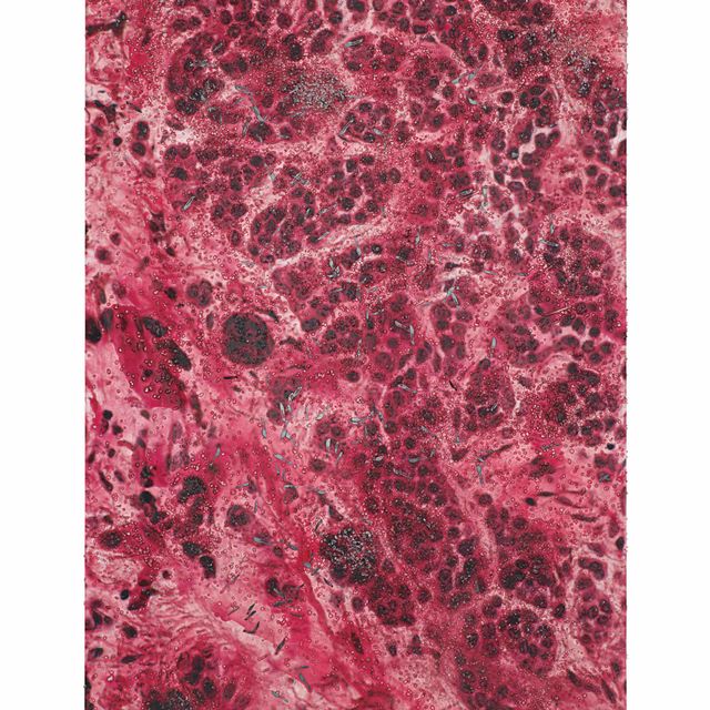 Damien Hirst — Родинка на коже M220/140, LM_SPL.jpg